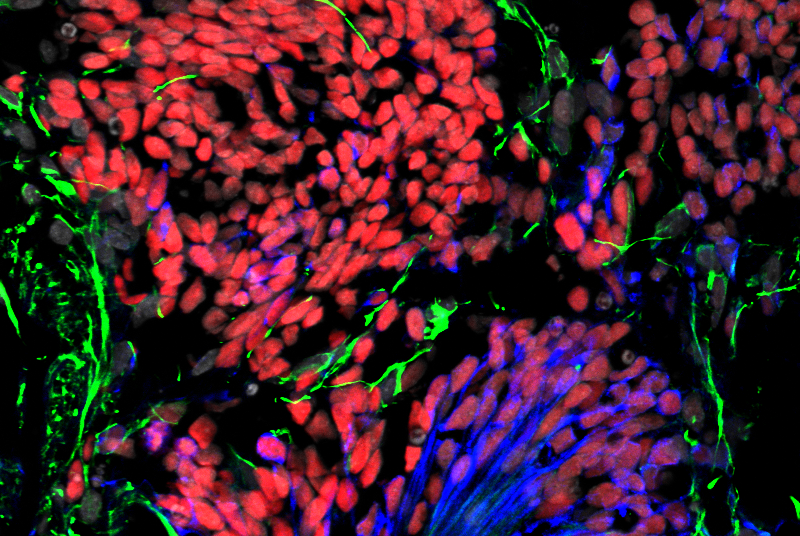 immunofluorescent image of Zika infecting brain organoids