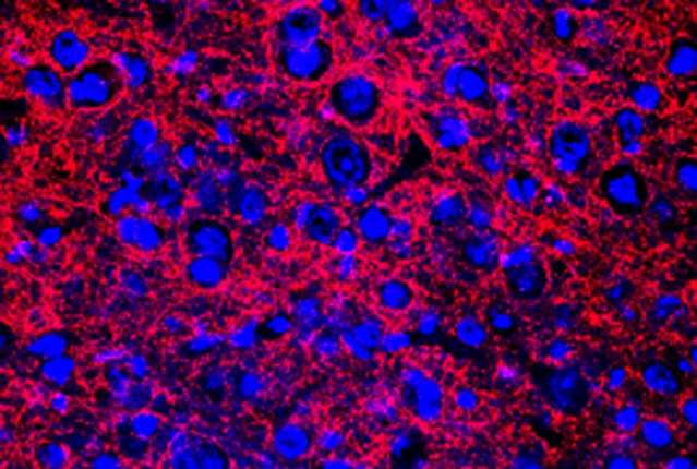 blue and red cells