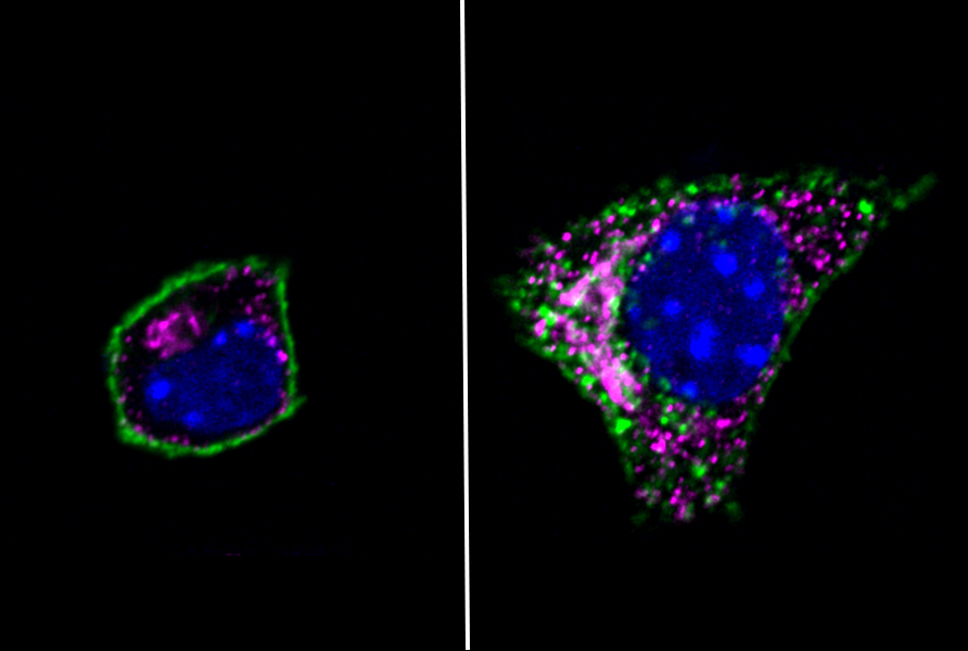 GIP receptor variant decreases risk of obesity