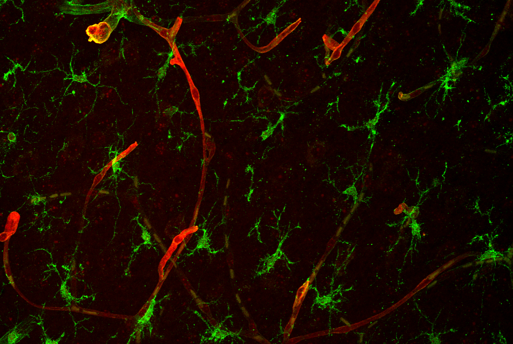 the main cell types that take up tumor-derived exosomes in brain tissue