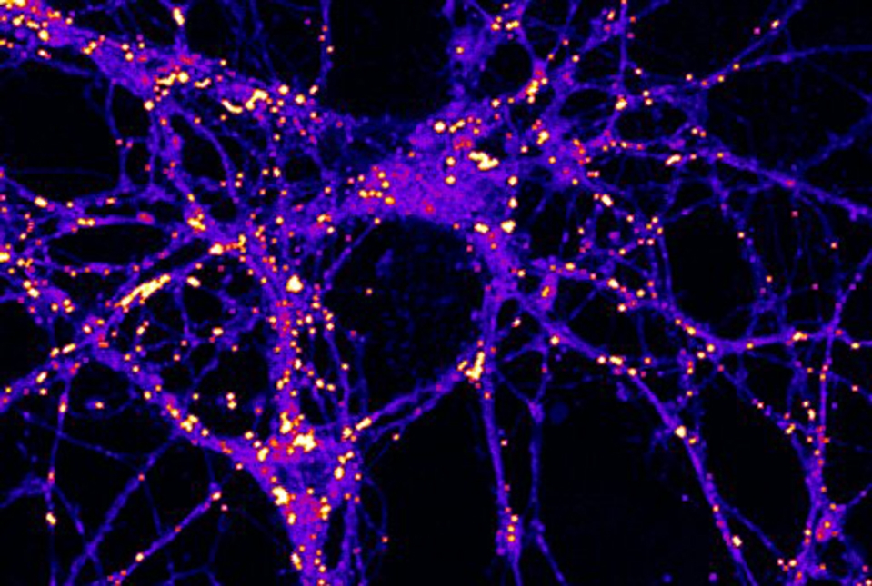 Neurons stained for lipid droplets