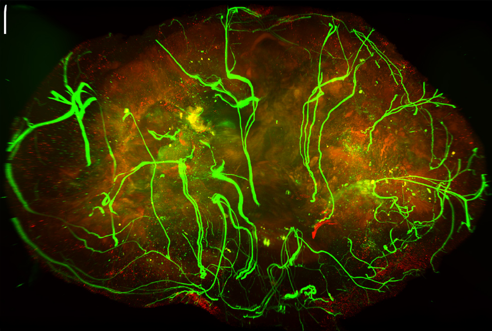 immunofluorescent image of nerves innervating melanoma