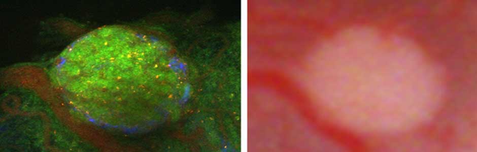 Visualizing pancreatic islets in vivo. Visualizing pancreatic islets in vivo.