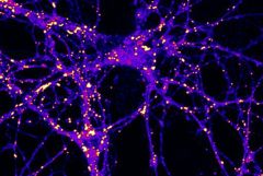 Fat May Play an Important Role in Brain Metabolism